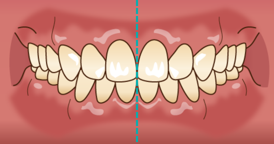 正中が揃っている歯並び