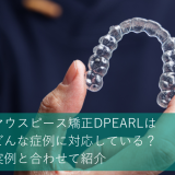 マウスピース矯正DPEARL（ディパール）はどんな症例に対応している？実例と合わせて紹介