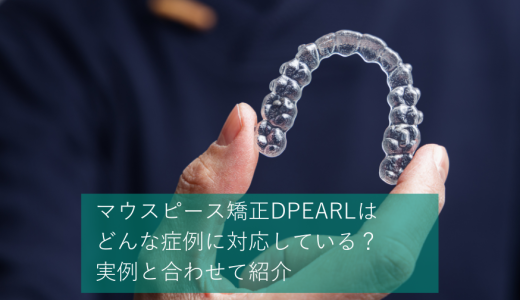 マウスピース矯正DPEARL（ディパール）はどんな症例に対応している？実例と合わせて紹介