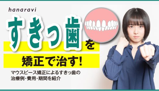 すきっ歯を矯正で治す！マウスピース矯正によるすきっ歯の治療例・費用・期間を紹介