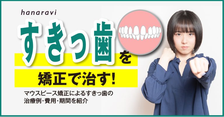 すきっ歯を矯正で治す！マウスピース矯正によるすきっ歯の治療例・費用・期間を紹介